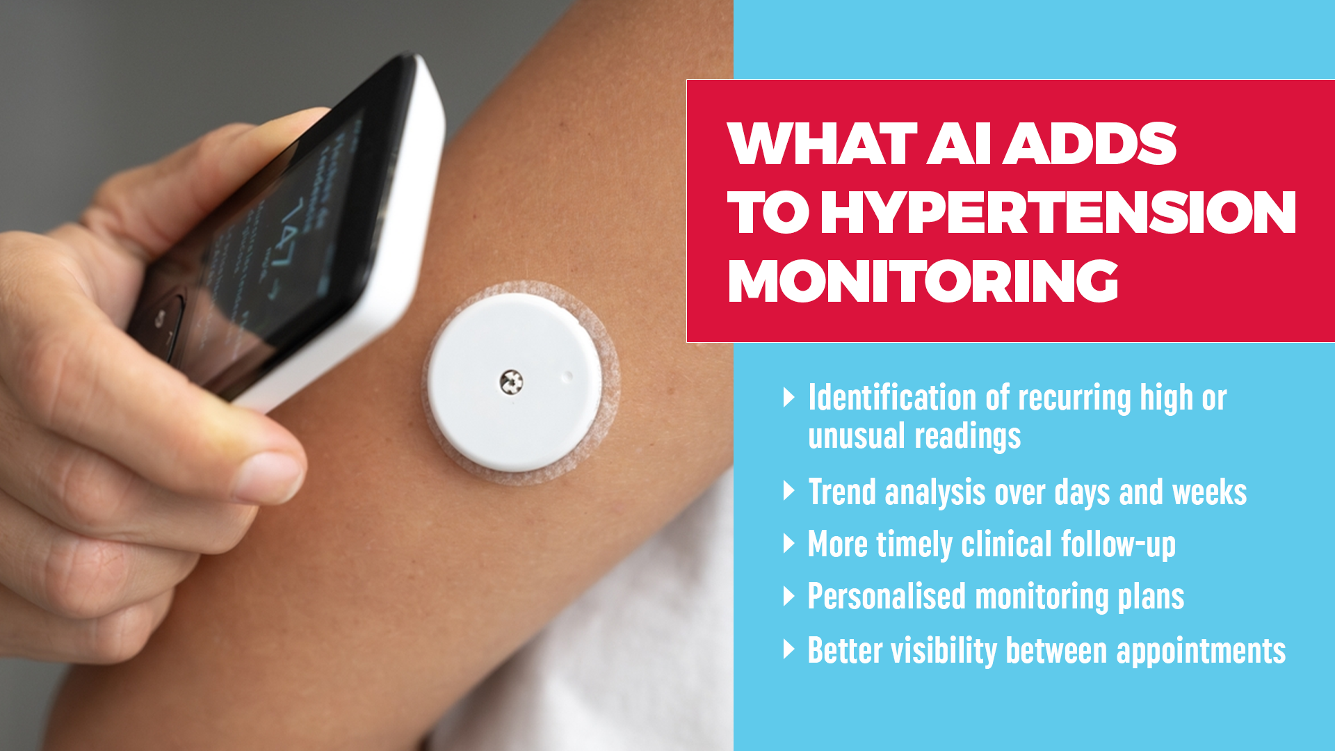 patient monitoring for hypertension